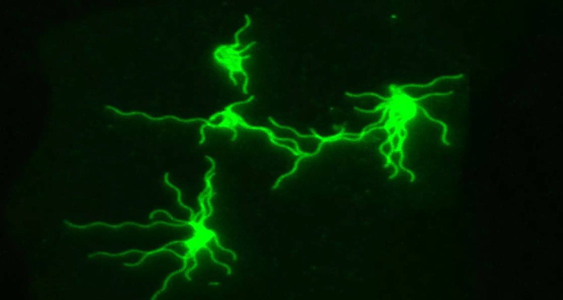E. coli cells seen under the fluorescence microscope