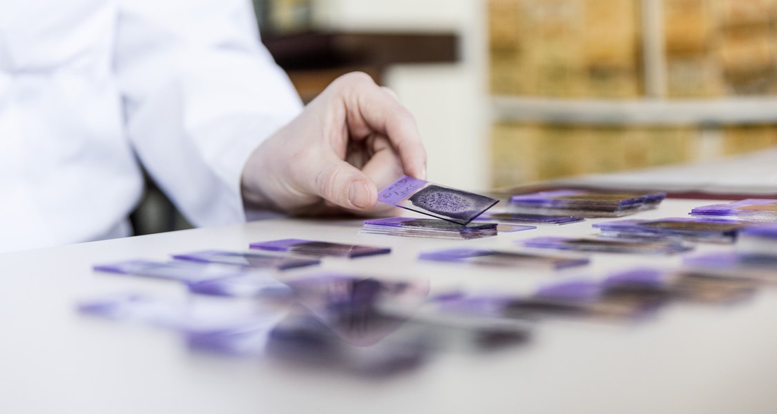 Cell sorting in cancer medicine
